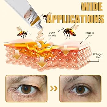 Botox- Bee Venom