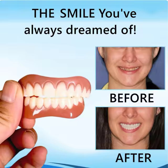 Furzero - Kit de rebase de dentadura postiza de silicona