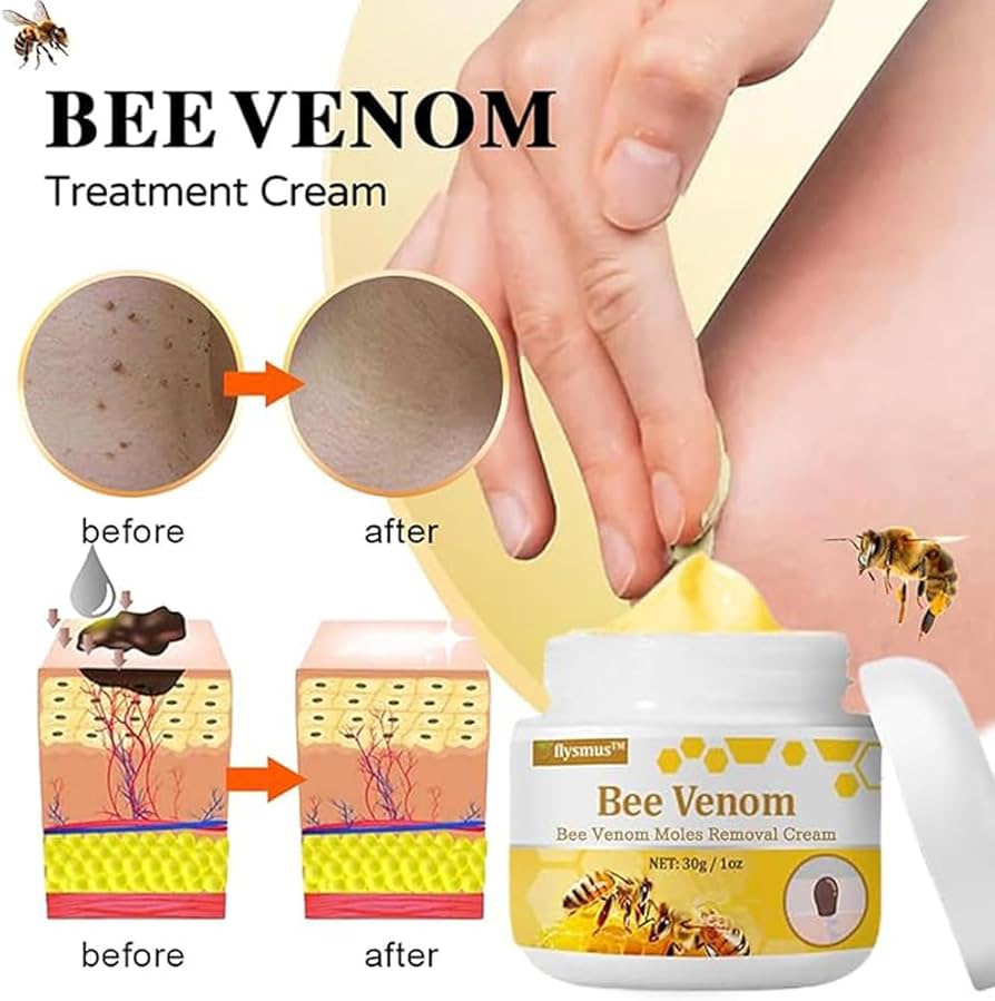 Crema para el tratamiento de lunares y verrugas con veneno de abeja